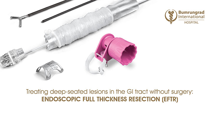 Full Thickness Resection Device (FTRD) used to treat lesions in GI tract using Endoscopic Full Thickness Resection (EFTR