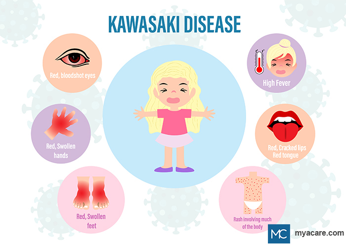 Kawasaki disease (KD) - red bloodshot eyes, red swollen hands & feet, high fever, red cracked lips, red tongue, rash on body