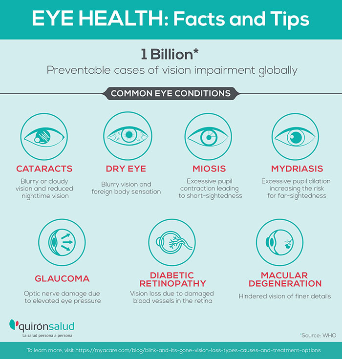 Eye Health - Common Eye conditions: Cataracts,Glaucoma,Dry Eye,Diabetic Retinopathy,Macular Degeneration,Miosis,Mydriasis