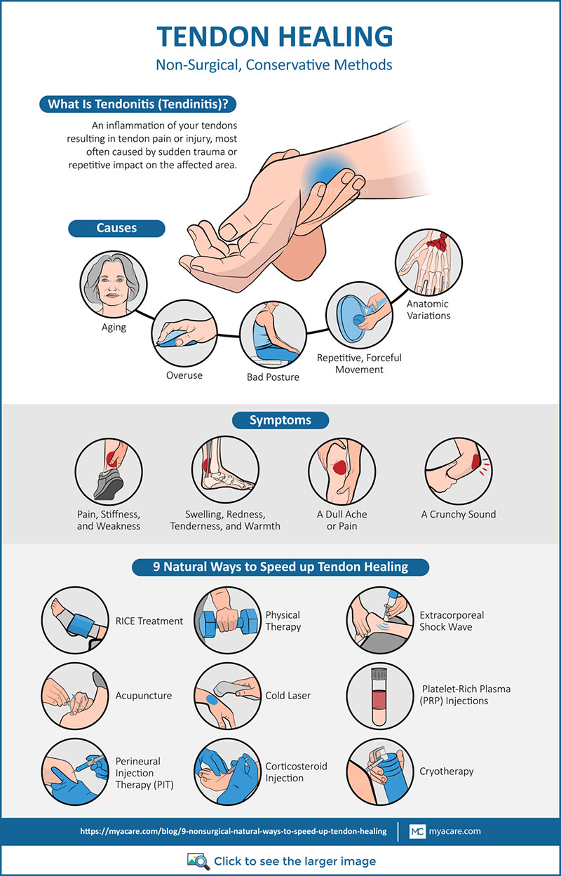 Tendonitis definition,Causes,Symptoms,non-surgical methods for tendon healing(RICE,PRP Injection,Acupuncture,Cold laser etc.)