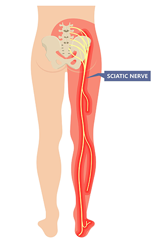 Sciatic nerve origin and course in the human body