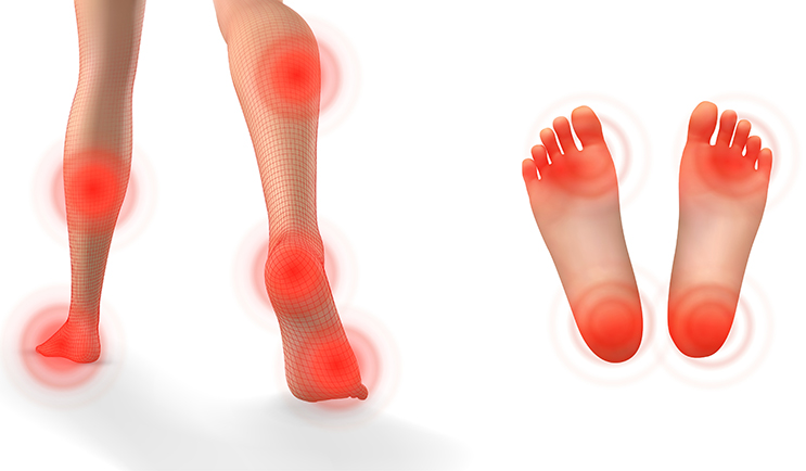 Motion sensor locations in the calf and foot for 3D gait analysis
