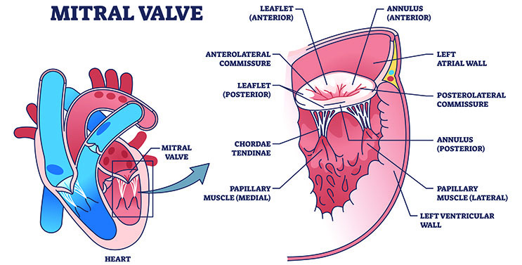Location of the Mitral Valve in the heart (Left), Mitral Valve anatomy (Right