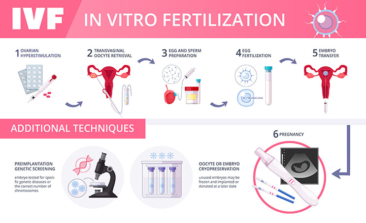 IVF treatment steps, Fertility preservation techniques - Preimplantation Genetic Screening and Oocyte/Embryo Cryopreservation