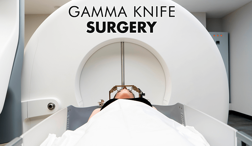 GAMMA KNIFE SURGERY: WHAT CAN IT TREAT BESIDES BRAIN TUMORS?