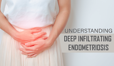 DEEP INFILTRATING ENDOMETRIOSIS: UNDERSTANDING AND MANAGING A COMPLEX CONDITION 