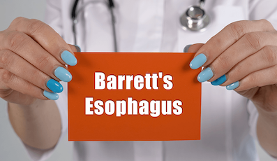 TREATMENT FOR BARRETT’S ESOPHAGUS