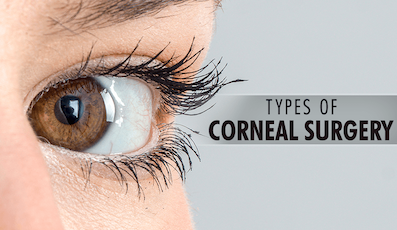 TYPES OF CORNEAL SURGERY: FROM TRANSPLANTS TO CROSS-LINKING