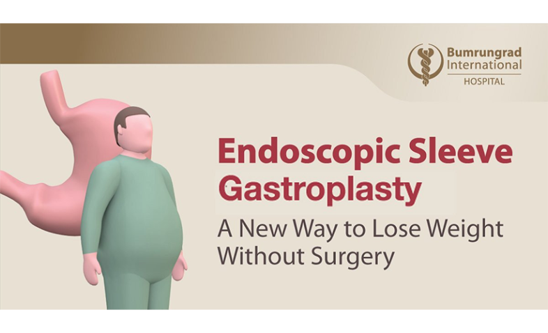 ENDOSCOPIC SLEEVE GASTROPLASTY: A NEW WAY TO LOSE WEIGHT WITHOUT SURGERY