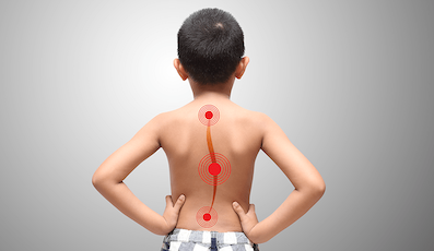 SCOLIOSIS AND KYPHOSIS SURGERY FOR CHILDREN - NEW INNOVATIONS