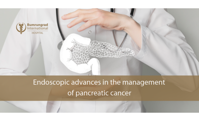 ENDOSCOPIC ADVANCES IN THE MANAGEMENT OF PANCREATIC CANCER