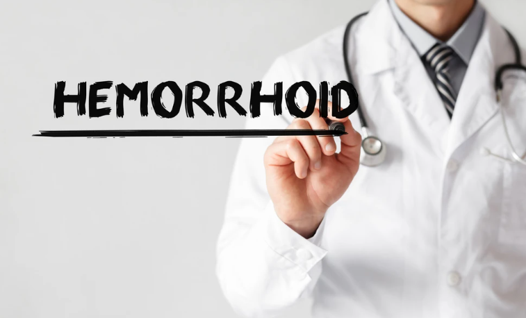 WHAT ARE HEMORRHOIDS